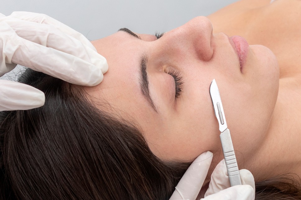 Dermaplaning